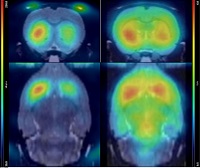 Example of Functional Imaging.