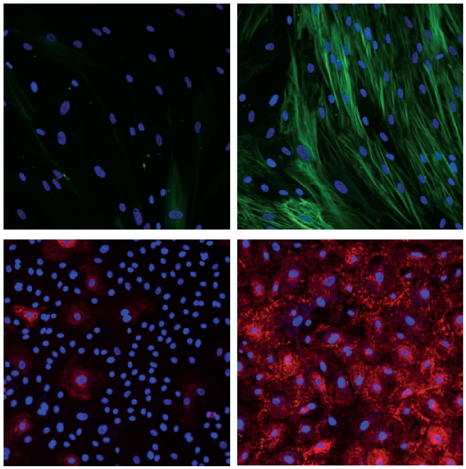 Scientific Poster entitled two in vitro assays relevant to lung fibrosis for evaluating the potency and efficacy of prospective anti-fibrotic drugs.