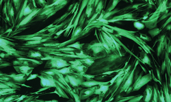 Human tumor cell lines developed from primary tumor material or patient-derived xenografts (PDX) for oncology research.