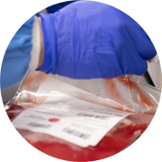 Mobilized Leukopaks.