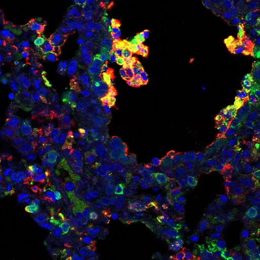 A confocal microscopy image of a mouse lung tissue following H1N1 infection.