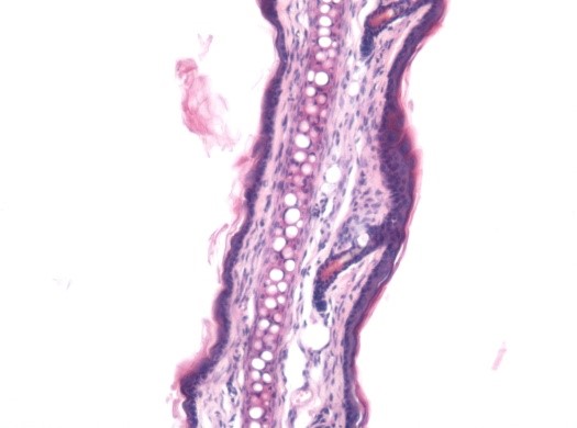 Histopathology (H&E staining) image of control untreated skin group in the Capsaicin-induced irritant contact dermatitis model