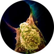 Metastasis of cancerous cell