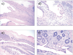 Screenshot from IBD poster inflammation and autoimmune T Cell assay and mouse models