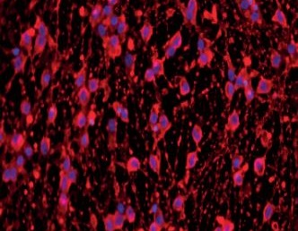 Robust and Scalable iPSC cells for HTS