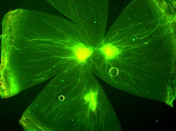 Corneal Neovascularization