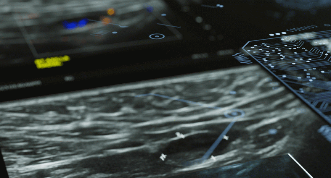 AI using in Imaging Studies