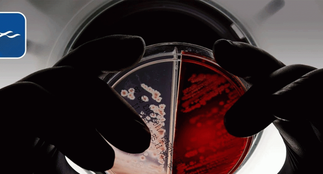 Lab worker eyeing an Agar Plate.