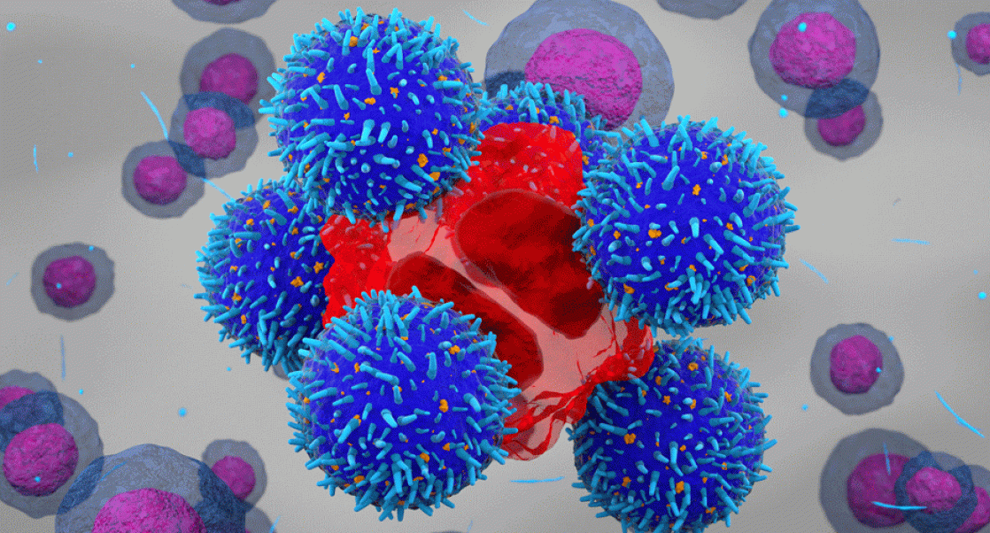 CAR_T cell therapy attacking a cancer cell