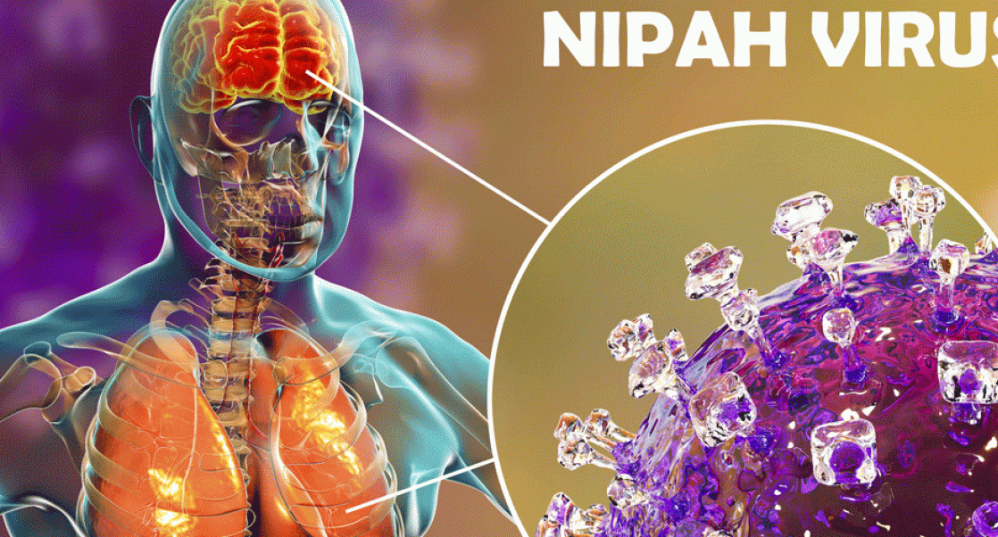 Nipah virus infecting brains and lungs