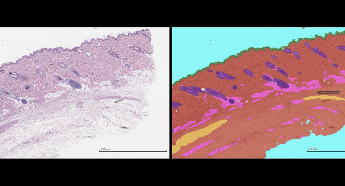 Conventional stain and AI-derived pathology tissue