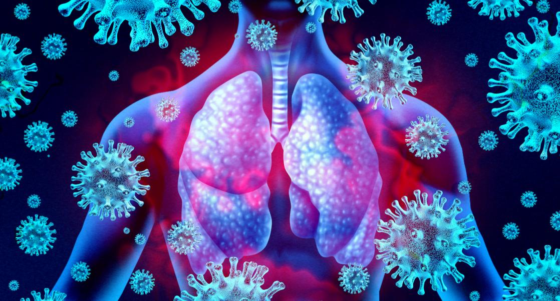 Test Your Knowledge of Lung Cancer