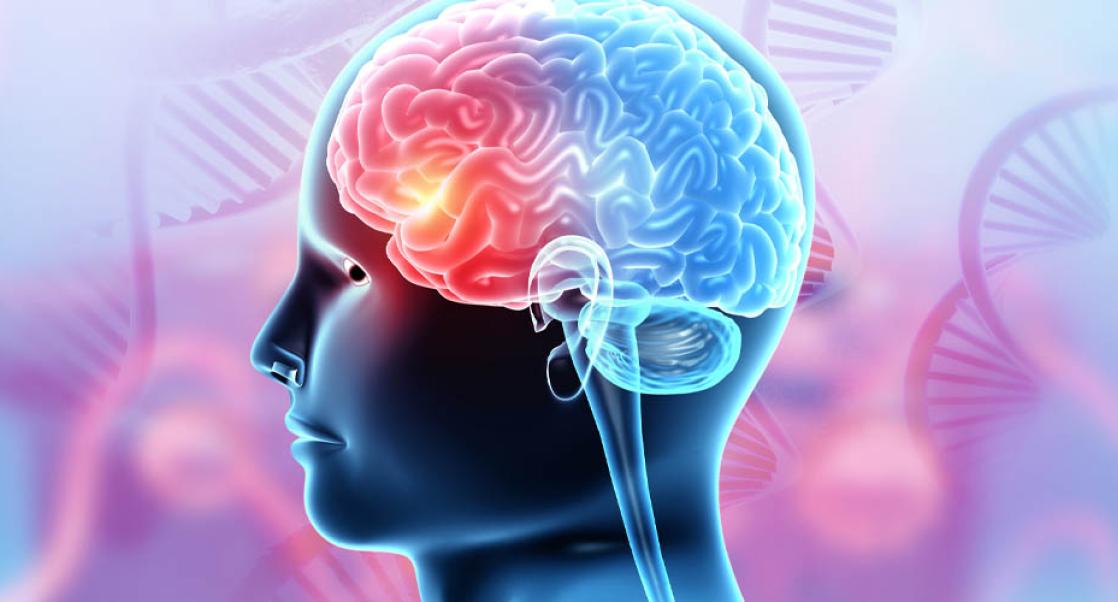stroke quiz