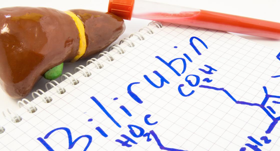 The Protective Effect of Gilbert syndrome