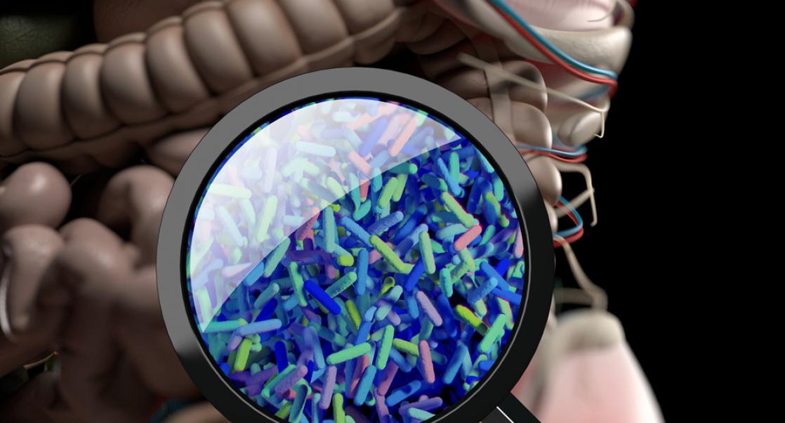 How Do We Target Ulcerative Colitis?