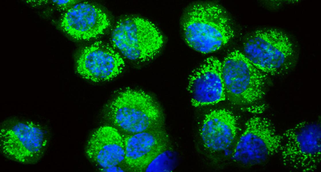 Optimizing Kinases in HD
