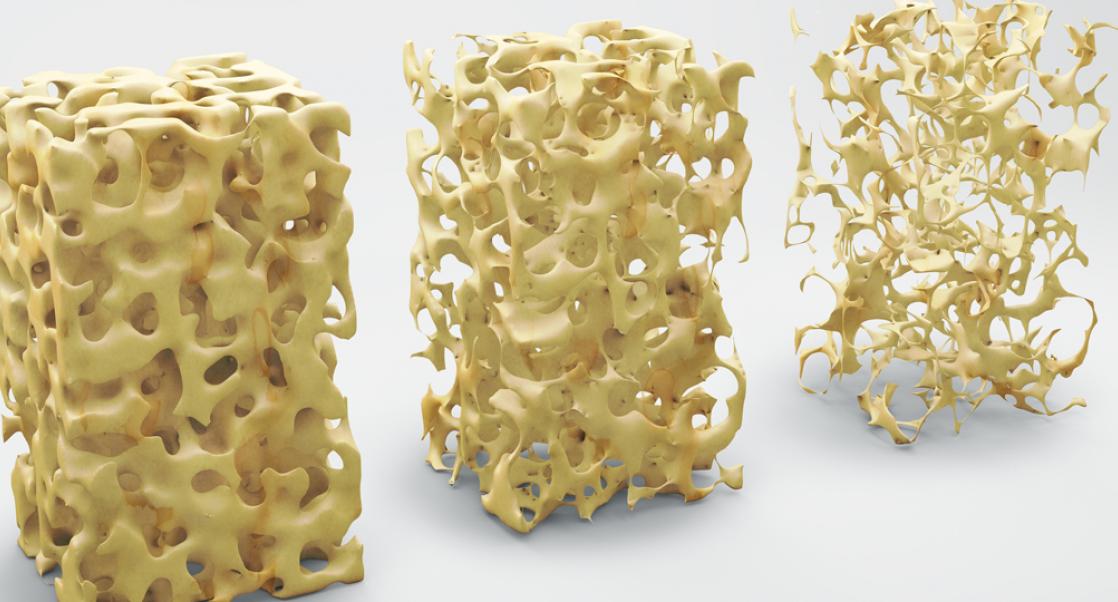 Antarctic Fish & Osteoporosis (Abstract Science: June 10-14)