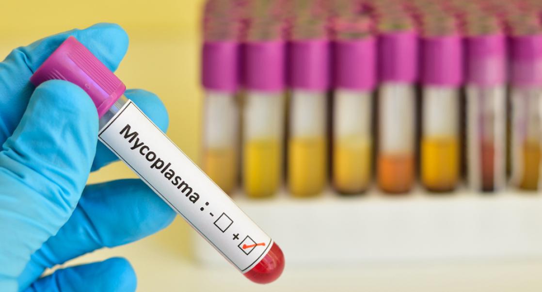 vial being tested for the presence of mycoplasma