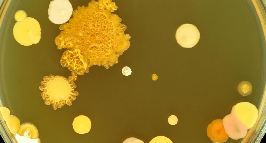 The Microbial Shuffle