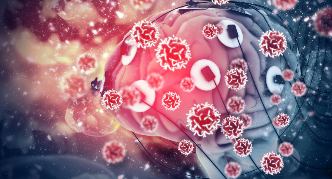 Hot Topic: Neuroinflammation (Video)