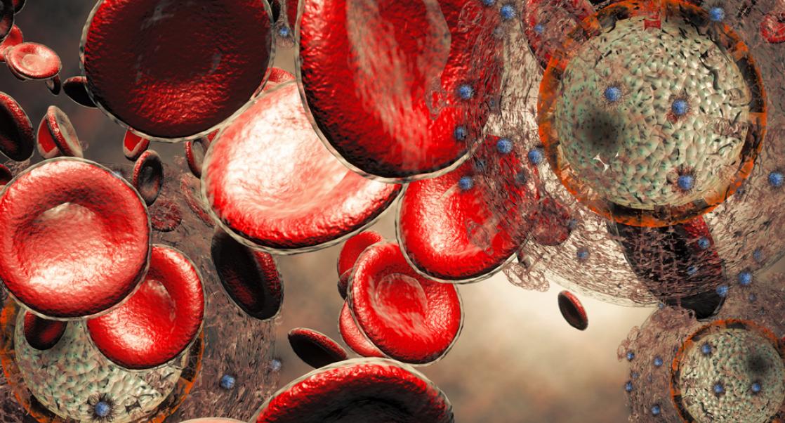 Science Clears HIV’s Patient Zero