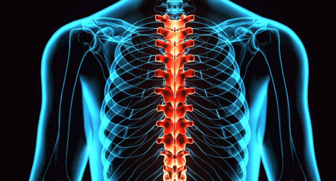 Neuroinflammation in Spinal Cord Injury: A Necessary Evil