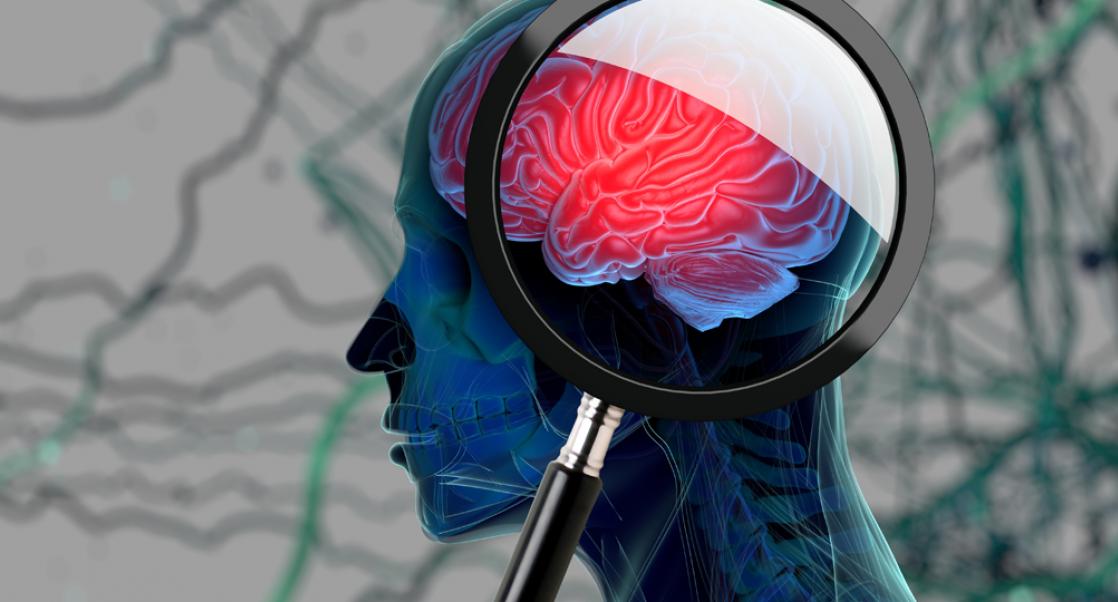 The New and the Old in Alzheimer’s Treatment