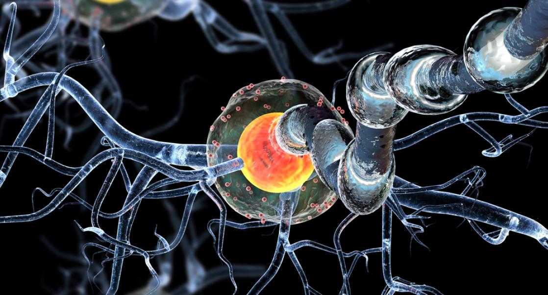 Spotlight on MS Research (Video)