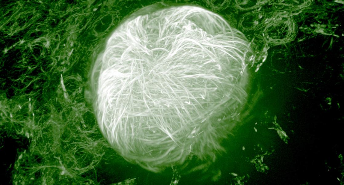 Eye on the Zebrafish