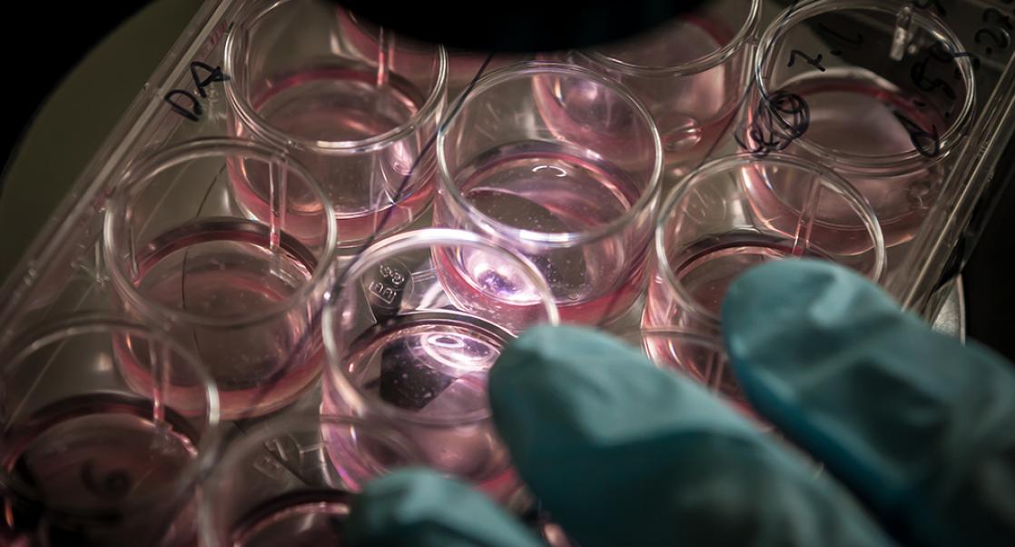 An Alternative Source of Pluripotent Stem Cells