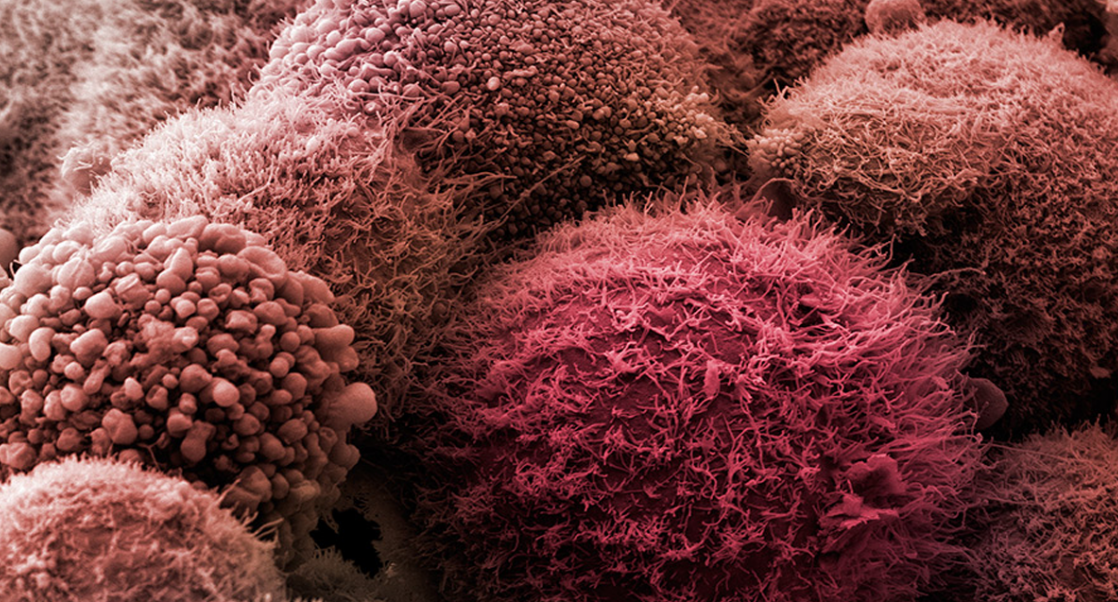 What Was Hot At AACR?