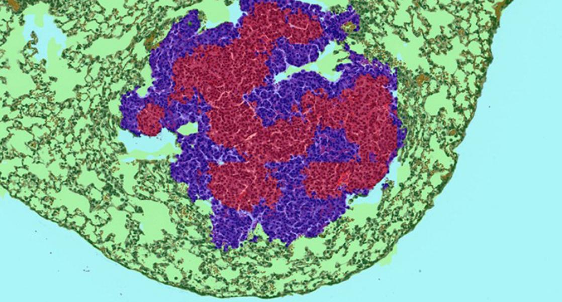What's Hot in 2020: Pathology