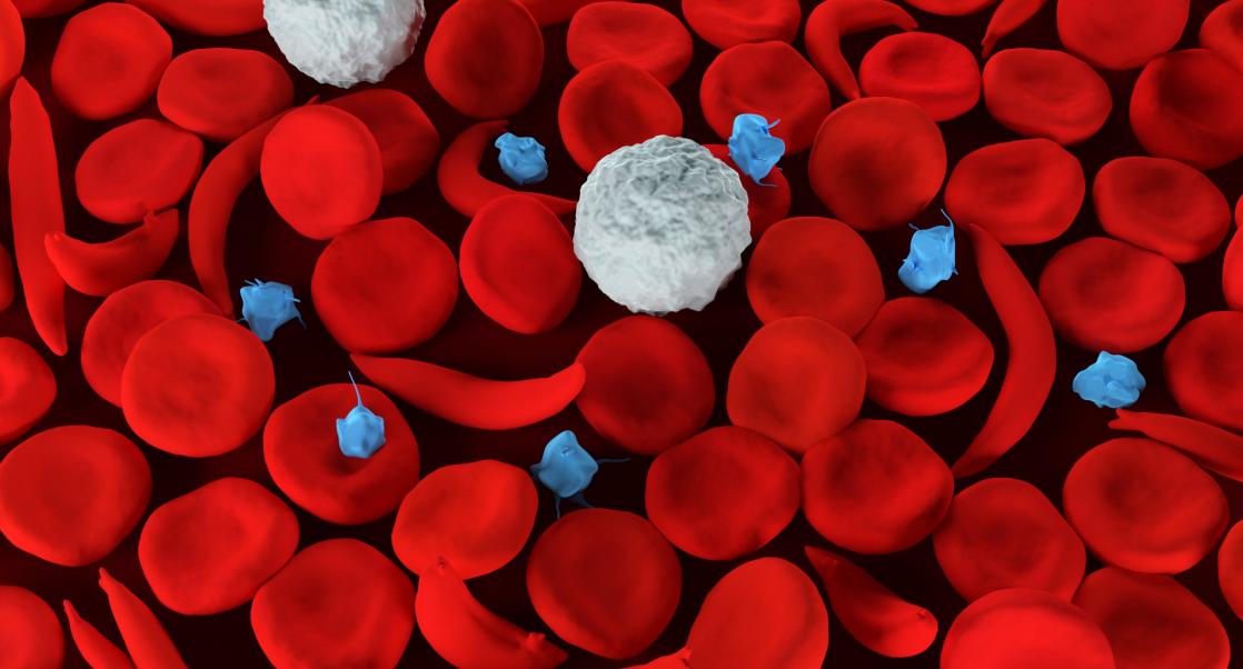 A Sickle Cell Warrior Soldiers through the Pandemic