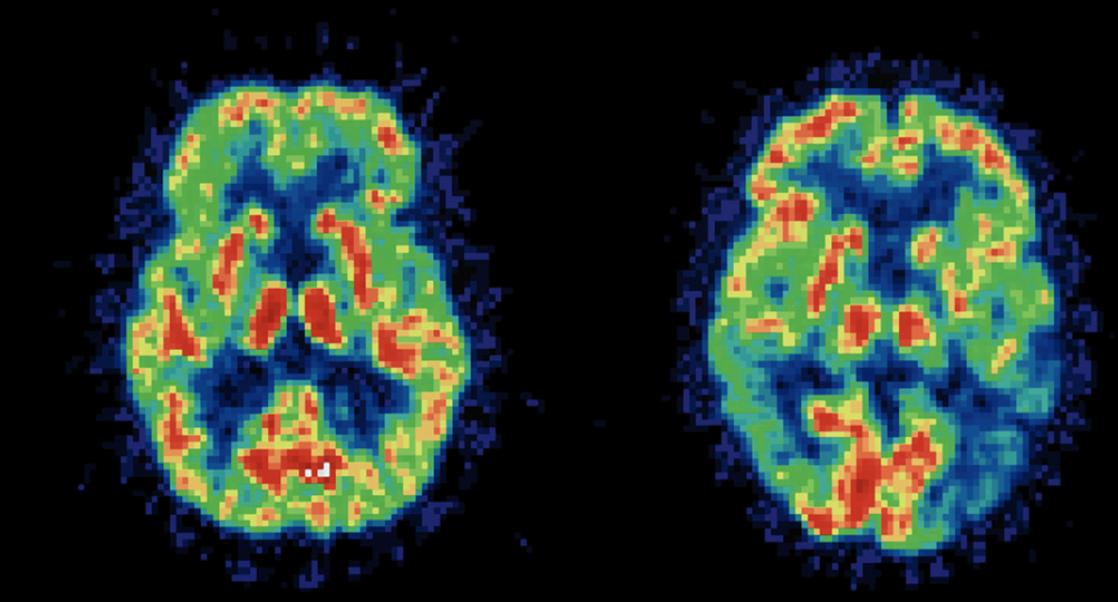 The Quest for Clinically Translatable Data