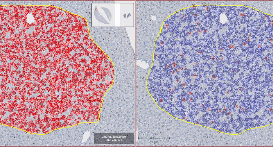 “Digitizing is Believing” with the New Microscope