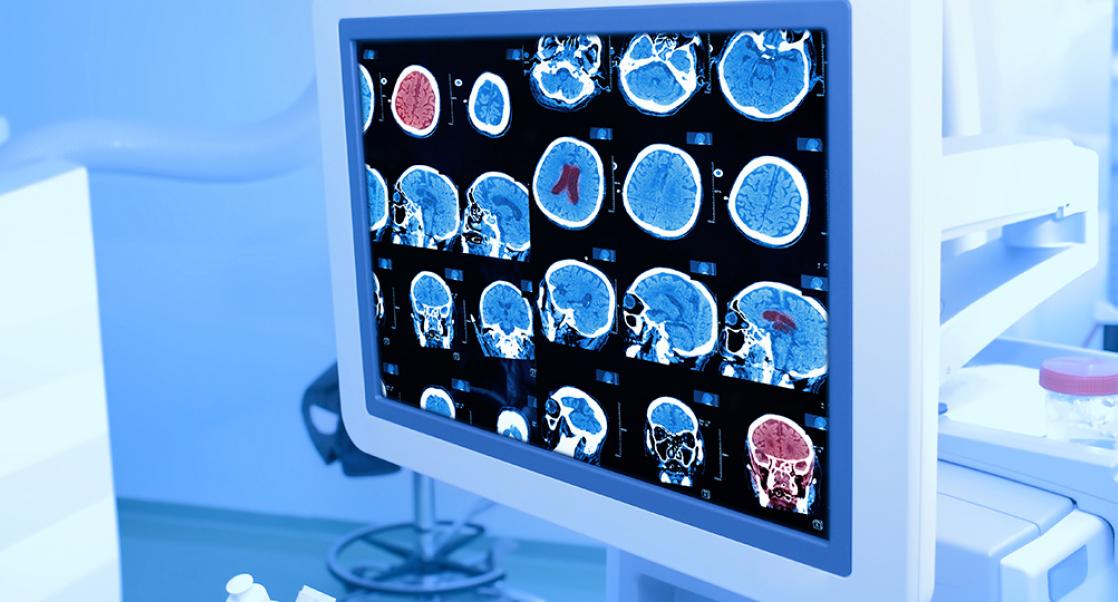 The Invention of Computed Tomography