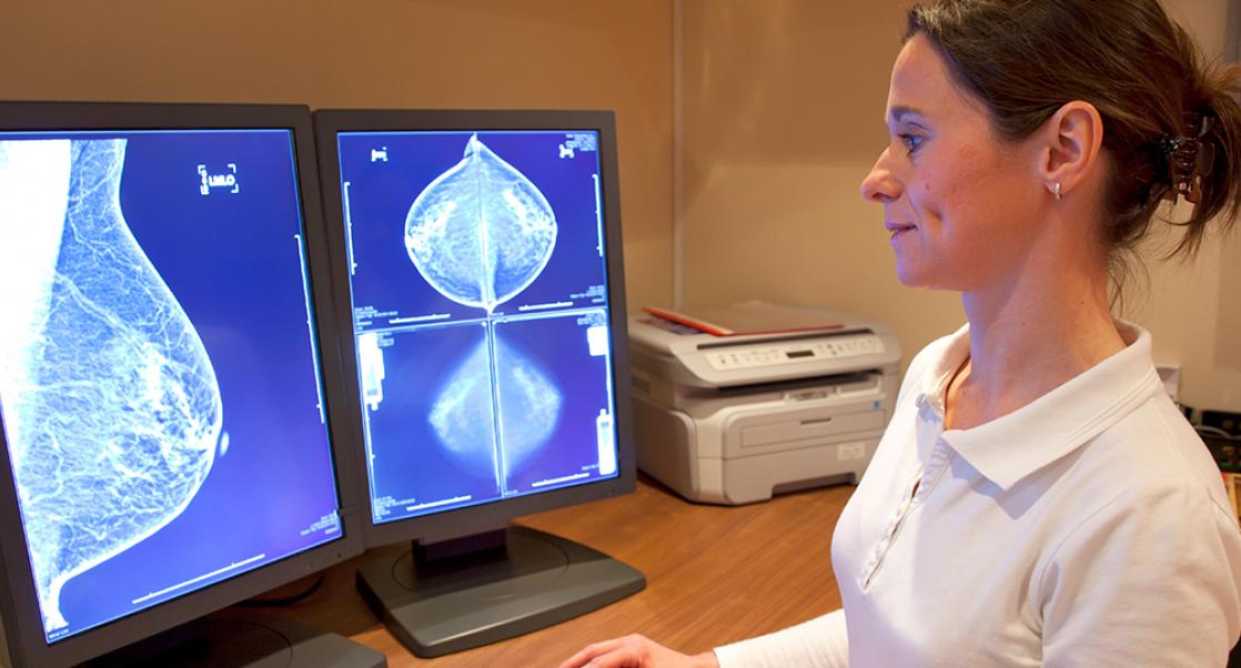 An Update on Mammography