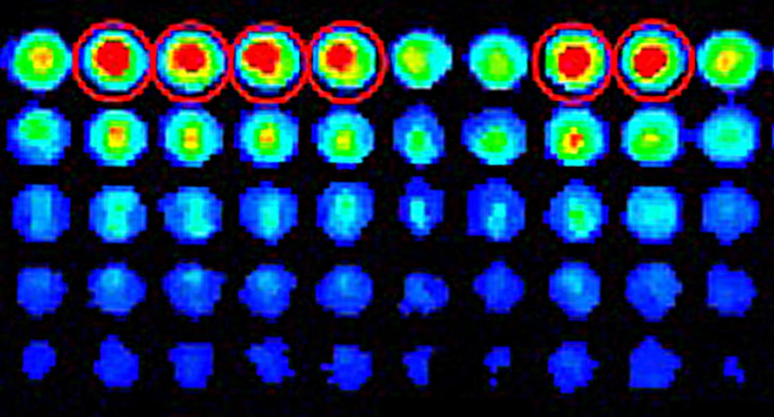 Shining a Light on Cancer