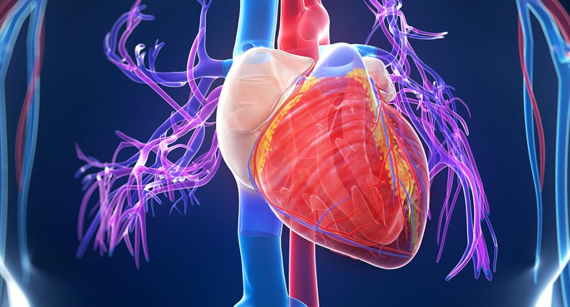 Diabetes Complications: CVS Disease