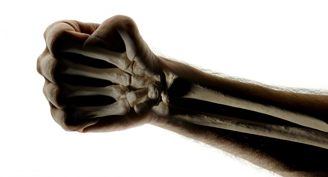 Amazing Insights into the Diabetes-Bone Connection