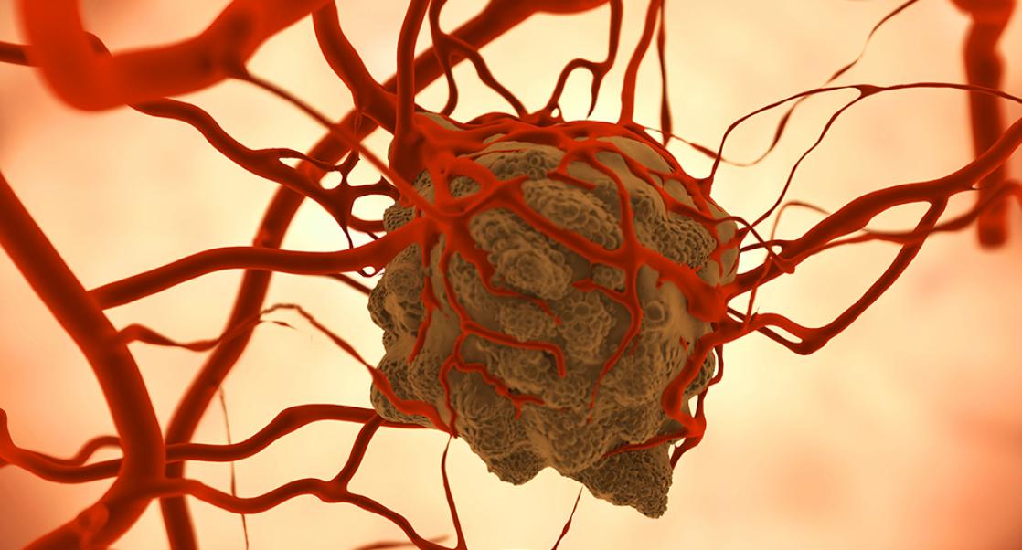 Blazing New Trails in Cancer Research