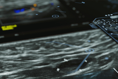 AI using in Imaging Studies