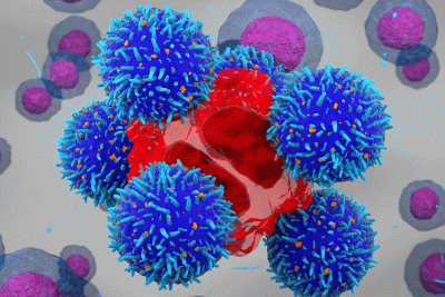 CAR_T cell therapy attacking a cancer cell