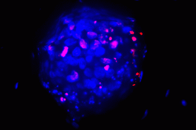 Image of a 3D tumor microenvironment