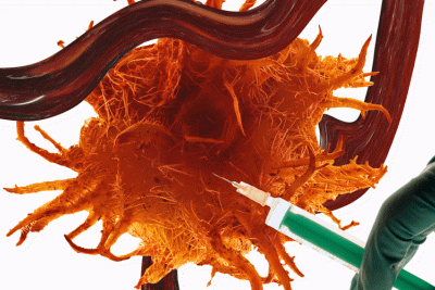 A physician injecting targeting a tumor with a vaccine