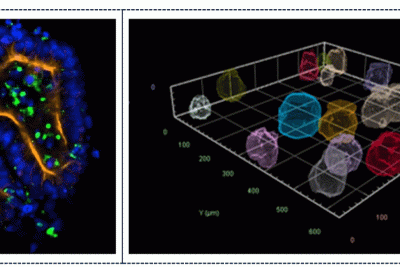High-Content Analysis of Organoid_1114x500