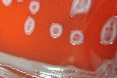 Lecleria adecarboxylata, an emerging pathogen