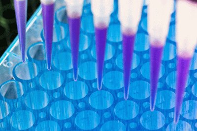 Pipetting in a 96 well plate. Image for liquid biopsy.