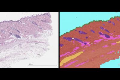 Conventional stain and AI-derived pathology tissue