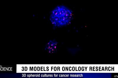 3D in vitro models in oncology